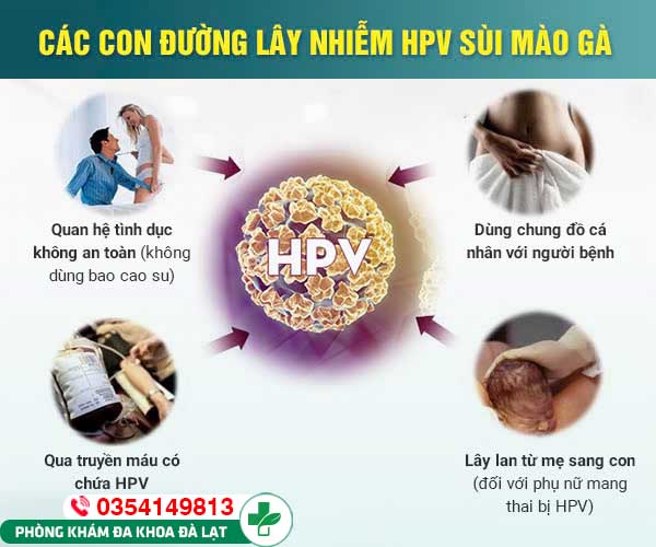 Hình ảnh minh họa